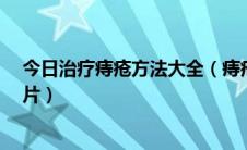 今日治疗痔疮方法大全（痔疮 痔疮的最佳治疗方法 痔疮图片）