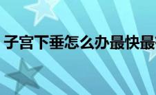 子宫下垂怎么办最快最有效(子宫下垂怎么办)