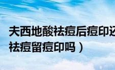夫西地酸祛痘后痘印还要继续擦么（夫西地酸祛痘留痘印吗）