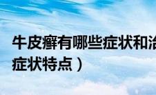 牛皮癣有哪些症状和治疗方法（牛皮癣有哪些症状特点）