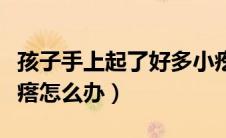 孩子手上起了好多小疙瘩（手上起了好多小疙瘩怎么办）