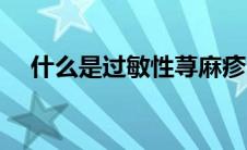 什么是过敏性荨麻疹（什么是过敏体质）