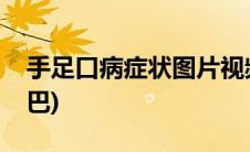 手足口病症状图片视频(手足口病症状图片嘴巴)