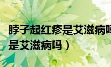 脖子起红疹是艾滋病吗会传染吗（脖子起红疹是艾滋病吗）