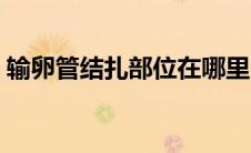 输卵管结扎部位在哪里（输卵管结扎的方法）