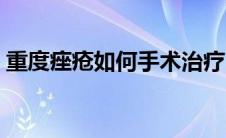重度痤疮如何手术治疗（重度痤疮如何治疗）