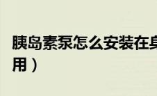胰岛素泵怎么安装在身体上（胰岛素泵怎么使用）