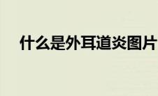 什么是外耳道炎图片（什么是外耳道炎）
