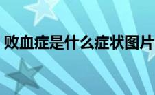 败血症是什么症状图片（败血症是什么症状）