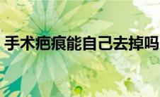 手术疤痕能自己去掉吗（手术疤痕能消除吗）