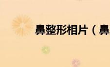 鼻整形相片（鼻整形相关知识）