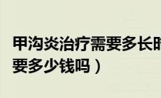 甲沟炎治疗需要多长时间能好（甲沟炎治疗需要多少钱吗）