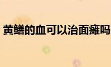 黄鳝的血可以治面瘫吗（黄鳝血如何治面瘫）