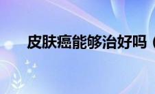 皮肤癌能够治好吗（皮肤癌能活几年）