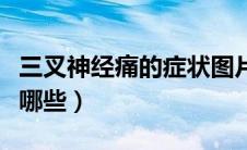 三叉神经痛的症状图片（三叉神经痛的症状有哪些）