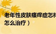 老年性皮肤瘙痒症怎样治（老年性皮肤瘙痒症怎么治疗）