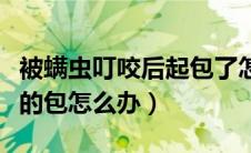 被螨虫叮咬后起包了怎么去除（出现螨虫叮咬的包怎么办）