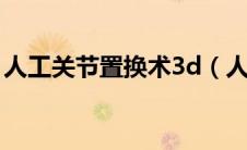 人工关节置换术3d（人工关节置换术是什么）