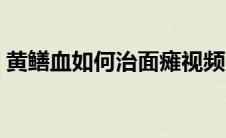黄鳝血如何治面瘫视频（黄鳝血如何治面瘫）