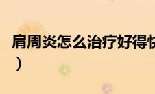 肩周炎怎么治疗好得快有效（肩周炎怎么治疗）