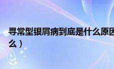 寻常型银屑病到底是什么原因（治疗银屑病的绿色疗法是什么）
