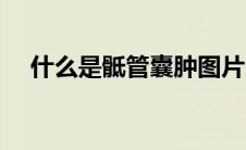 什么是骶管囊肿图片（什么是骶管囊肿）