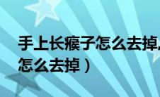 手上长瘊子怎么去掉,不痛不痒（手上长瘊子怎么去掉）