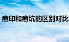 痘印和痘坑的区别对比（痘印和痘坑的区别）