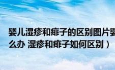 婴儿湿疹和痱子的区别图片婴儿湿疹怎么办（宝宝长痱子怎么办 湿疹和痱子如何区别）