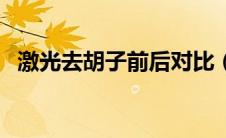 激光去胡子前后对比（激光去胡子的效果）