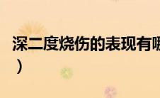 深二度烧伤的表现有哪些（什么是深二度烧伤）