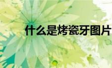 什么是烤瓷牙图片（什么是烤瓷牙）