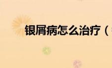银屑病怎么治疗（银屑病怎么治疗）
