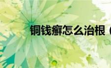 铜钱癣怎么治根（铜钱癣怎么治）