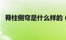脊柱侧弯是什么样的（脊柱侧弯是怎样的）