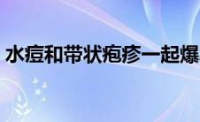 水痘和带状疱疹一起爆发（水痘和带状疱疹）