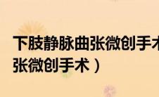 下肢静脉曲张微创手术会复发吗（下肢静脉曲张微创手术）