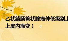 乙状结肠管状腺瘤伴低级别上皮内瘤变（管状腺瘤伴低级别上皮内瘤变）