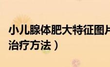 小儿腺体肥大特征图片（小儿腺体肥大的最佳治疗方法）