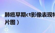 肺癌早期ct影像表现特点（肺癌的早期症状ct片图）