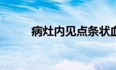 病灶内见点条状血流信号（病灶）