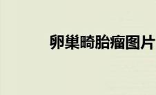 卵巢畸胎瘤图片（崎胎瘤图片）