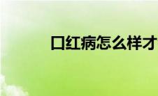 口红病怎么样才会好（口红病）