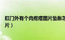 肛门外有个肉疙瘩图片坠胀怎么回事（肛门外有个肉疙瘩图片）