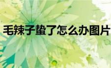 毛辣子蛰了怎么办图片（毛辣子蛰了怎么办）