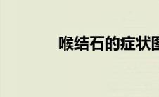 喉结石的症状图片（喉结石）