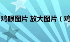 鸡眼图片 放大图片（鸡眼图片挖出根部图片）