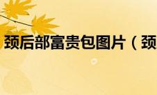 颈后部富贵包图片（颈后的富贵包怎么治疗）