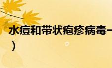 水痘和带状疱疹病毒一样吗（水痘和带状疱疹）