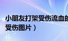 小朋友打架受伤流血的图片卡通（小朋友打架受伤图片）